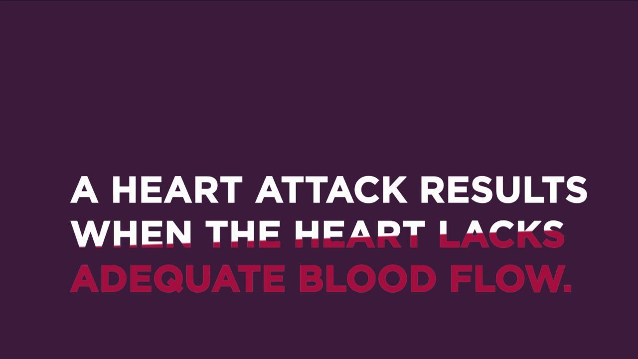 A heart attack results when the heart lacks adequate blood flow. Do you know how to recognize the signs and symptoms of a heart attack?