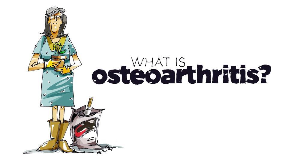 Whiteboard Osteoarthritis